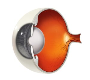 Cataracts Affect More Than Just The Elderly